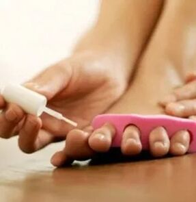 Aplicación de verniz terapéutico